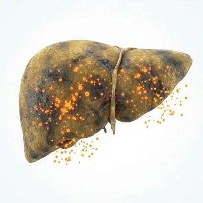 Liver